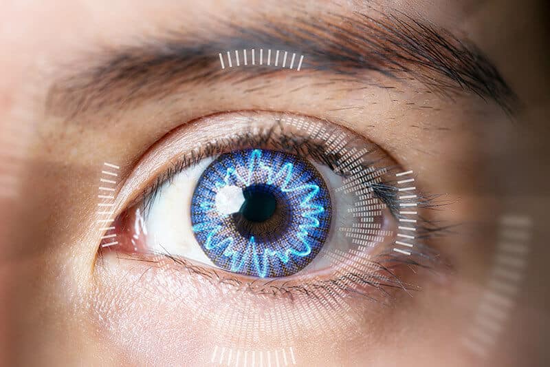 Closeup of an Eye With Corneal Crosslinking